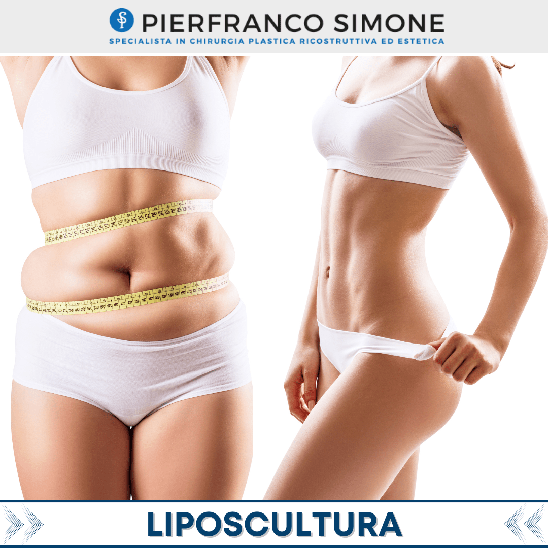 Liposcultura (12)