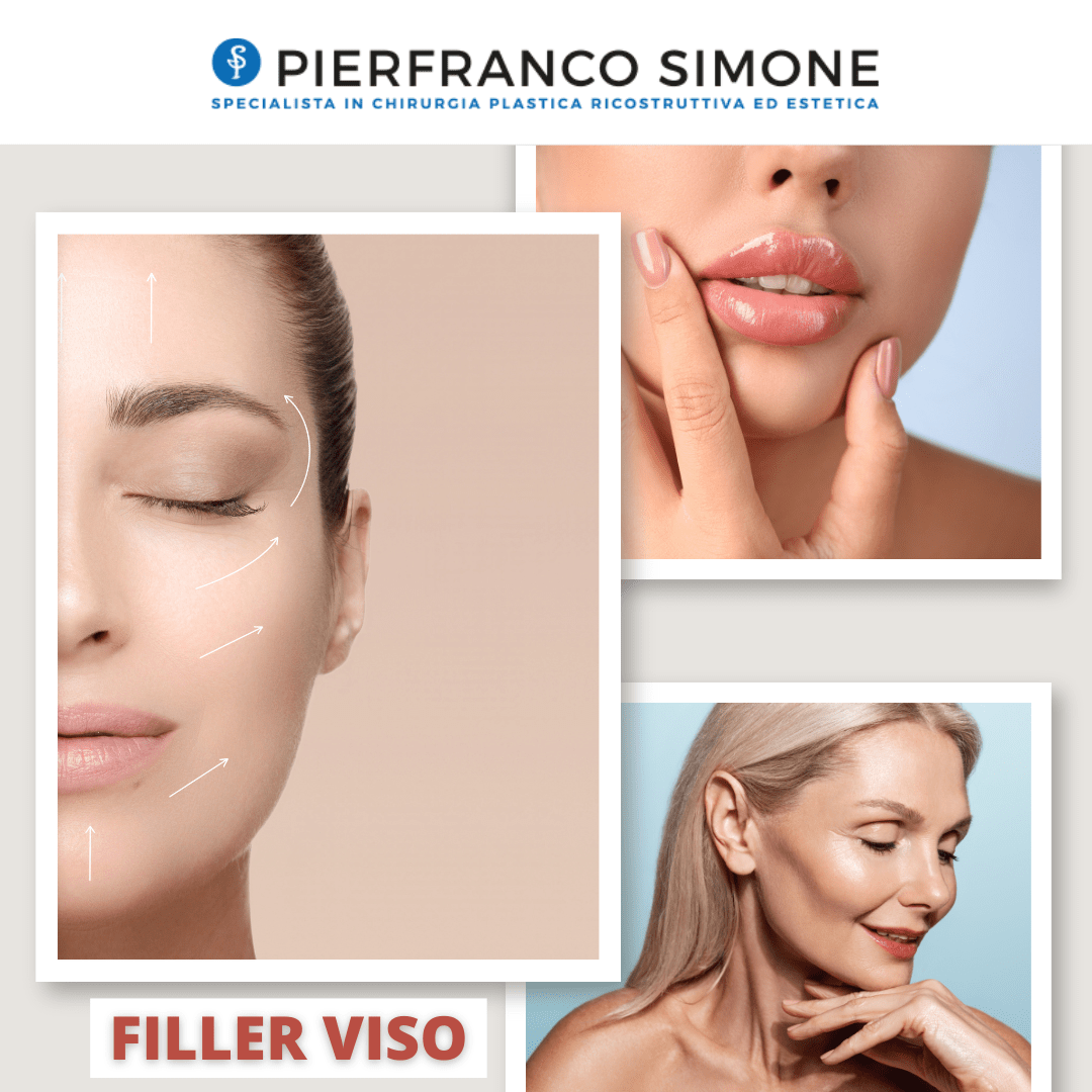 filler viso (2)